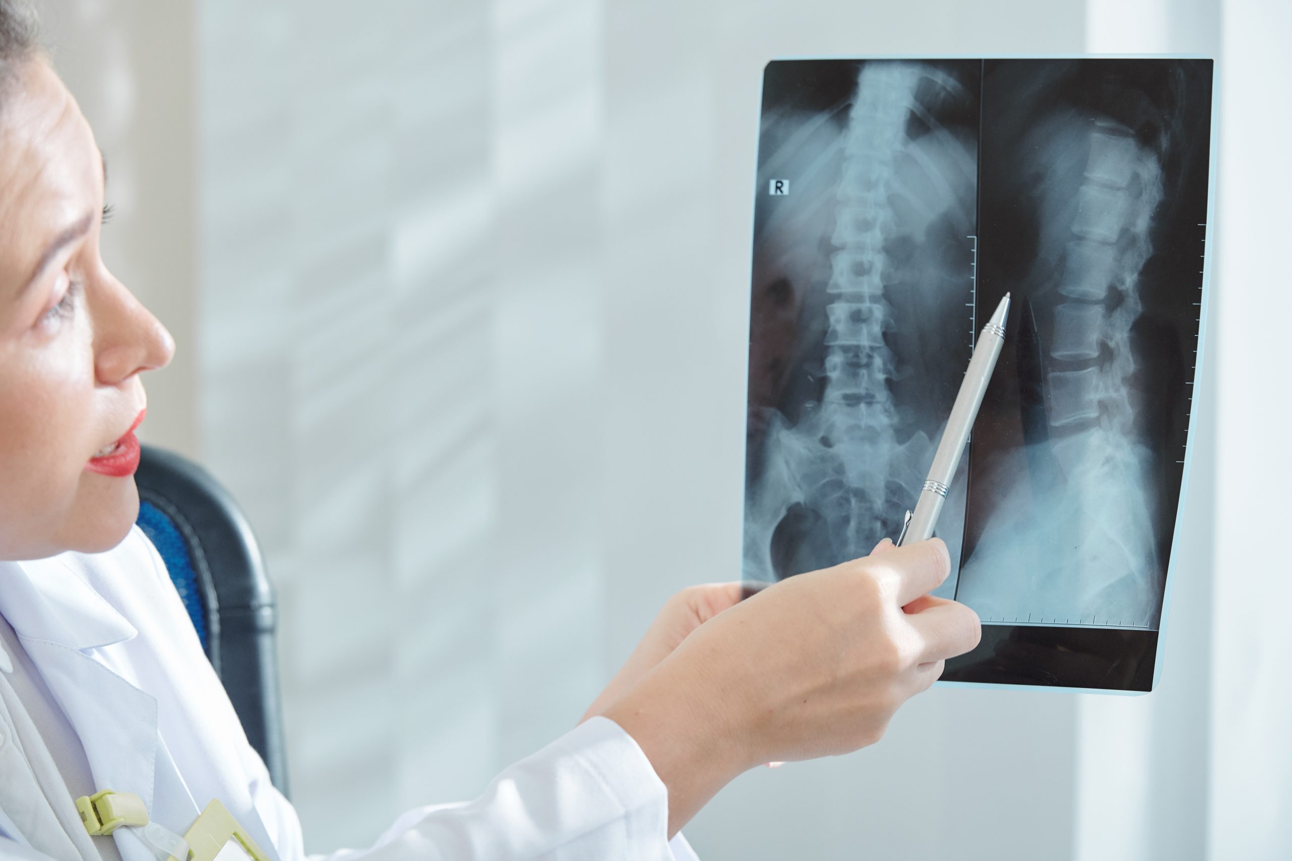 Transforaminal Lumbar Interbody Fusion