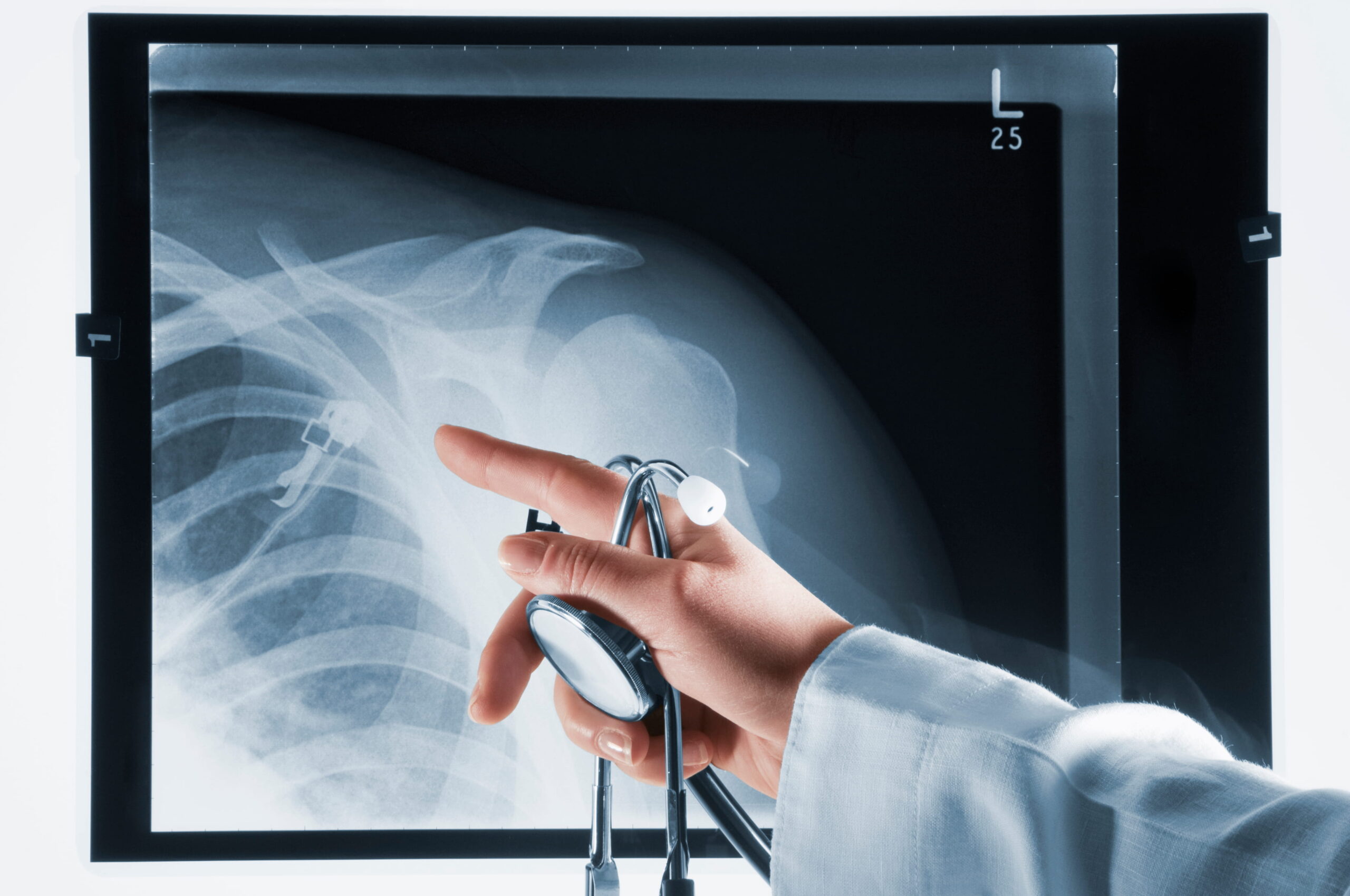 MRI IMAGING